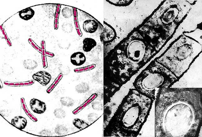 Микропрепарат бактерий. Бациллы под световым микроскопом. Микроскопия бактерий. Сенная палочка микроскопия. Бактериальная клетка в световом микроскопе.