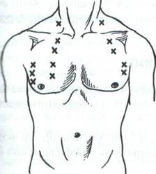 Аускультация легких рисунок