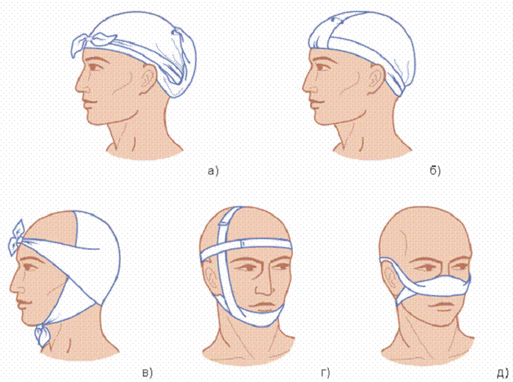 Косыночная повязка на голову техника. Наложение косыночных повязок на голову. Косыночная повязка на голову алгоритм. Косыночная перевязка на голову. Как перевязывать голову