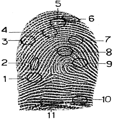 Частные признаки узора. Дистальная зона папиллярного узора. Способы выявления следов папиллярных узоров. Головка и ножки петли папиллярных узоров. Папиллярный узор фото.