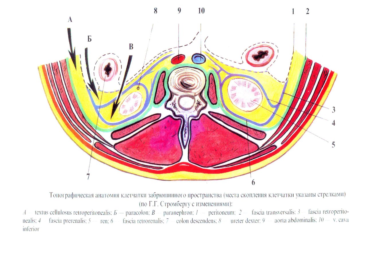 Сагиттальный распил забрюшинного пространства схема