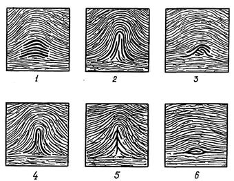 В зависимости от рисунка центральной части ногтевого фаланга пальца руки папиллярные узоры бывают