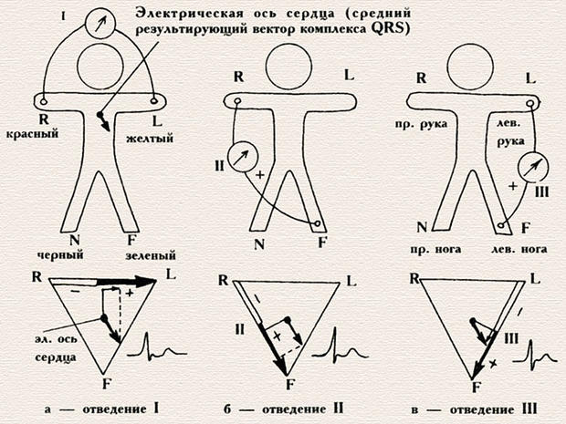 Положение экг. Стандартные отведения ЭКГ схема. ЭКГ при стандартных отведениях. 1 Стандартное отведение ЭКГ. Отведения ЭКГ электрическая ось сердца.