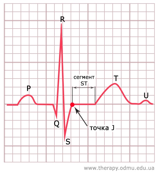 Сегмент st на экг. Сегмент St на ЭКГ на изолинии. Сегмент St на ЭКГ В норме. Отрицательный сегмент St на ЭКГ. На ЭКГ зубец т на изолинии.