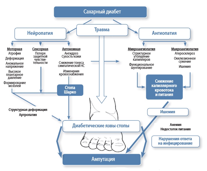 Диабет диагностика лечение. Синдром диабетической стопы патогенез. Синдром диабетической нейропатии. Патогенез диабетической нейропатии схема. Патогенез развития диабетической стопы.