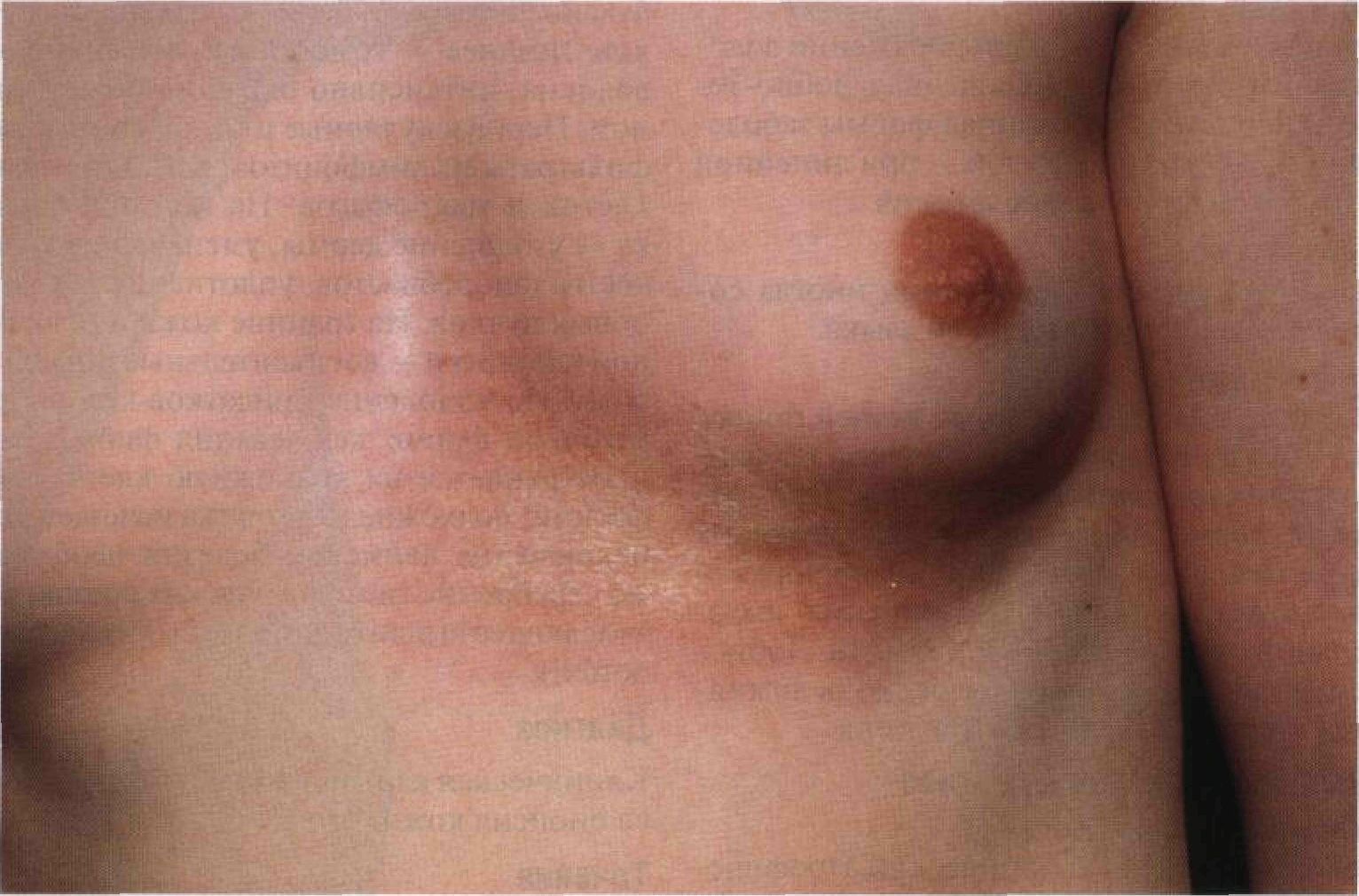 к чему чешется сосок левой груди женщин фото 111