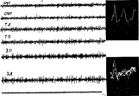 Нейрохимический определитель. Вызванные потенциалы мозга у животных. Нейрохимическая осцилляция. Нейрохимический след.