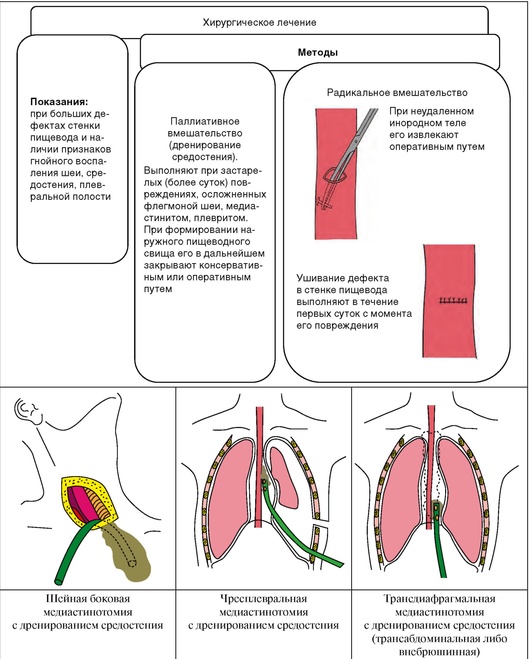 Заболевания пищевода факультетская хирургия презентация