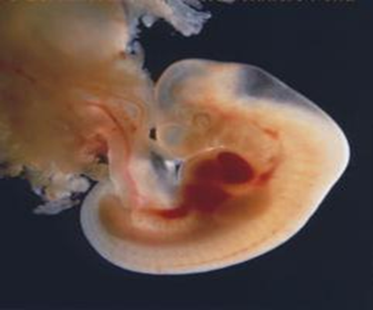 Как выглядит зародыш на 4 неделе беременности фото