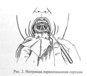 Ларингоскопия это