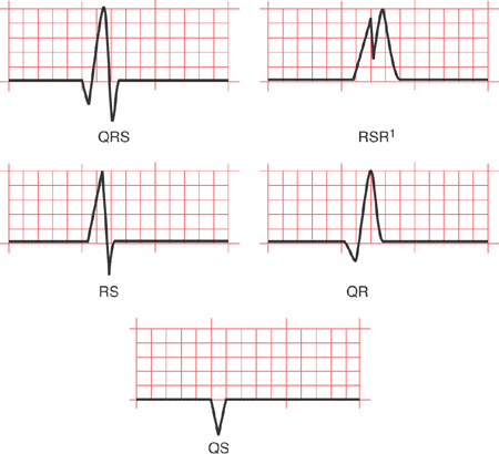 Комплекс qrs. Зубец QS на ЭКГ. Комплекс QRS типа QS. Комплекс QRS на ЭКГ. Комплекс QRS на ЭКГ типа r.