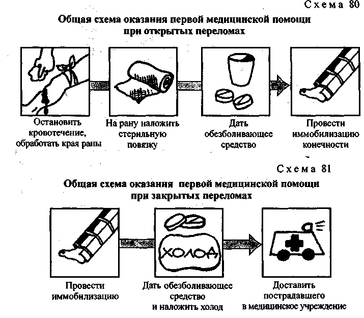 Алгоритм первой помощи при открытом переломе