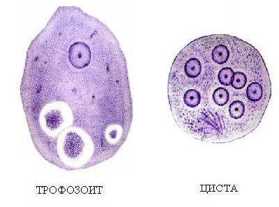Кишечная амеба рисунок
