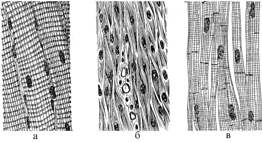 Поперечно полосатая мышечная ткань рисунок