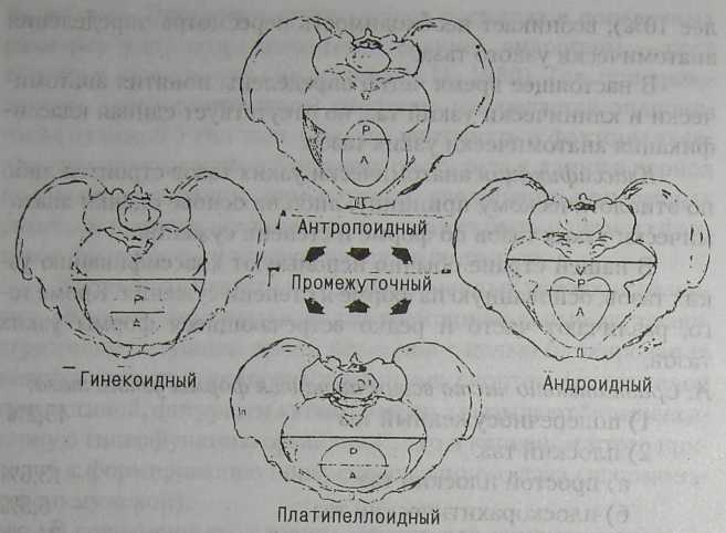 Гинекоидный таз. Формы таза. Формы женского таза гинекоидная Андроидная. Классификация узкого таза по форме Caldwell-Moloy. Антропоидный таз.