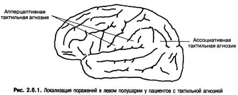 Тактильные агнозии презентация