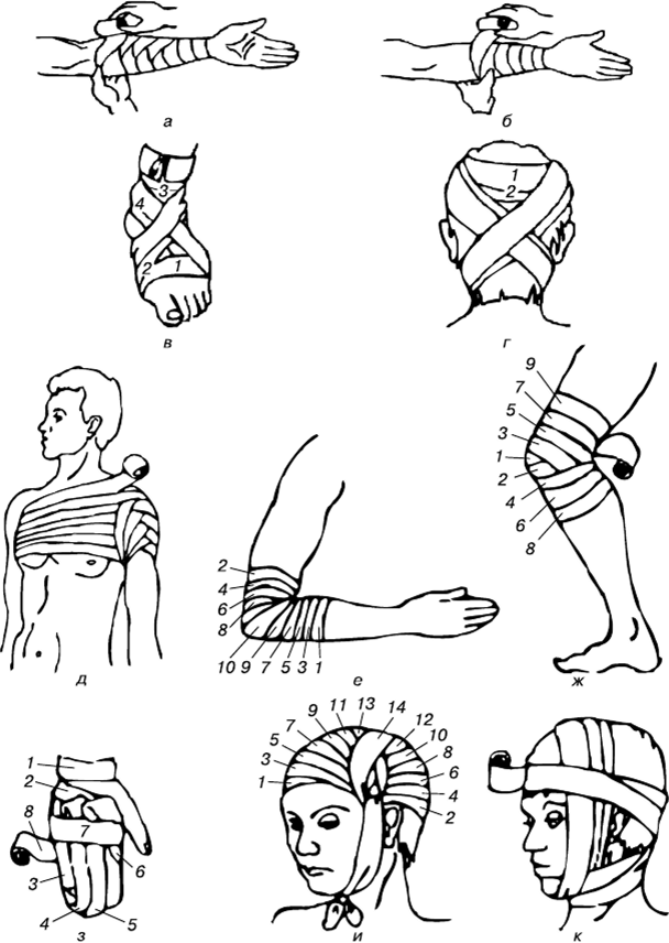 Типы бинтовых повязок рисунок
