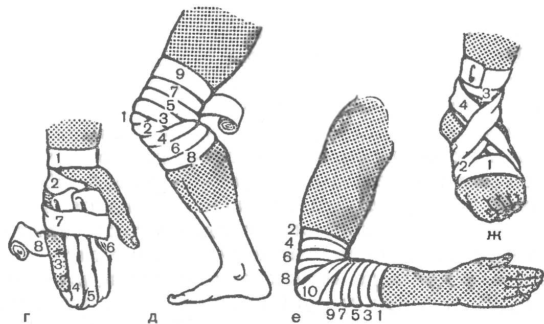 Рисунки наложения повязок
