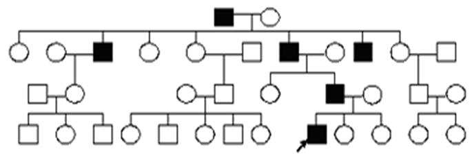 Голандрический Тип наследования пробанд. Голандрический Тип наследования генотип пробанда. Генотип пробанда в следующей родословной. Пробанд дерево.