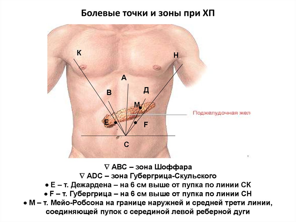 Болевые точки и зоны при поражении желчного пузыря нарисовать