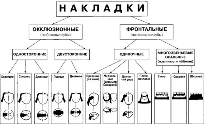 Система нея. Классификация окклюзионных накладок. Кламмера классификация. Классификация кламмеров таблица. Система кламмеров нея.