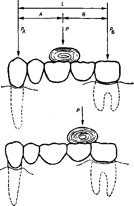 Реферат: Флюороз зубів
