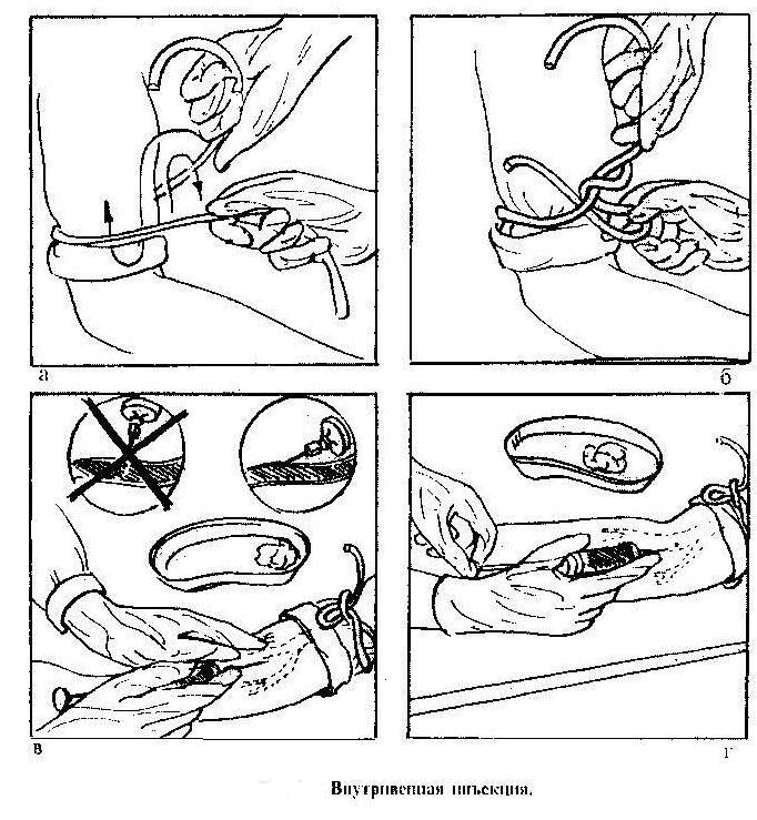 Как правильно держать шприц при внутривенной инъекции фото