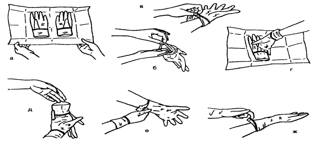 Надевание стерильных перчаток фото