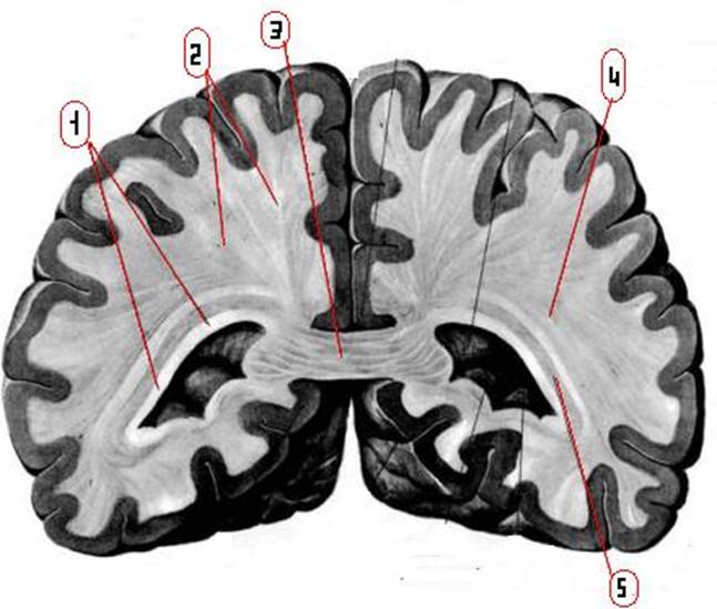 Серый мозг латынь. Белое вещество и мозолистое тело головного мозга. Строение мозолистого тела головного мозга анатомия. Строение белого вещества полушарий головного мозга.