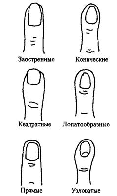 Узловатые пальцы. Коническая форма пальцев. Форма пальцев на руках. Типы форм пальцев. Пальцы лопатообразной формы.